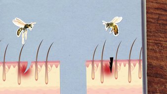Comment la guêpe et l’abeille piquent-elles ?